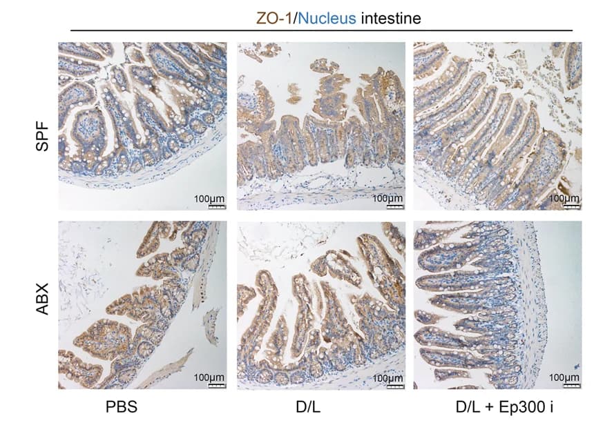 Open access visualization of Microscopy, Immunohistochemistry, IHC images, ZO-1, Mouse Intestine