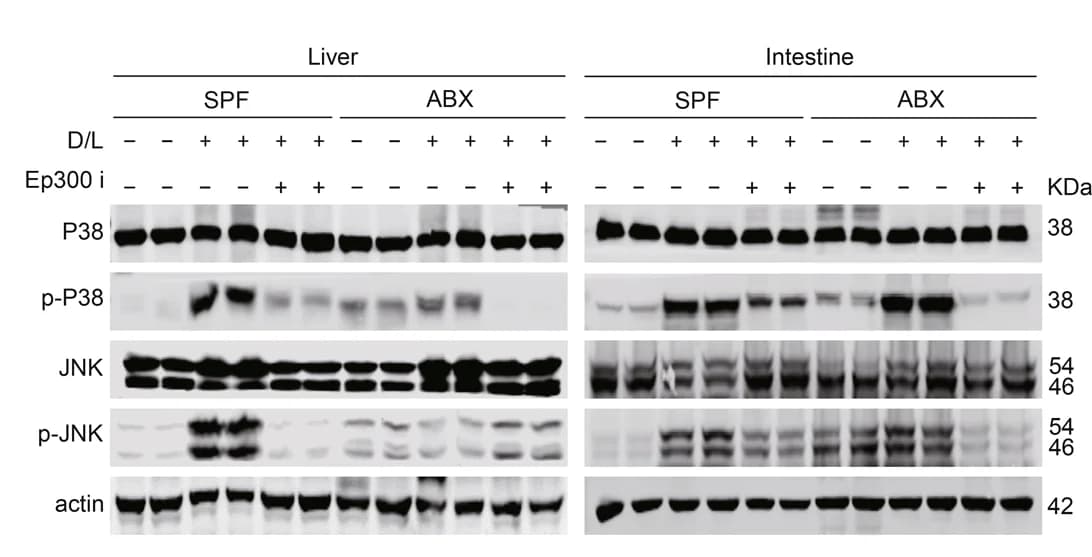 Open access visualization of Gel, P38, p-P38, JNK, p-JNK