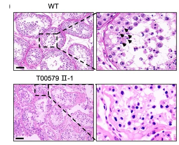 Open access visualization of Microscopy, Hematoxylin & Eosin Staining, Testicular Biopsy, Wild-Type, Mutant Individual