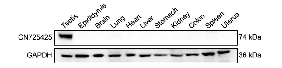 Open access visualization of Gel, Western Blotting, Mouse Tissues, GAPDH, Internal Control