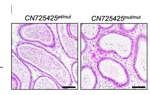 Open access visualization of Microscopy, H&E Staining, Cauda Epididymis, Adult Mice