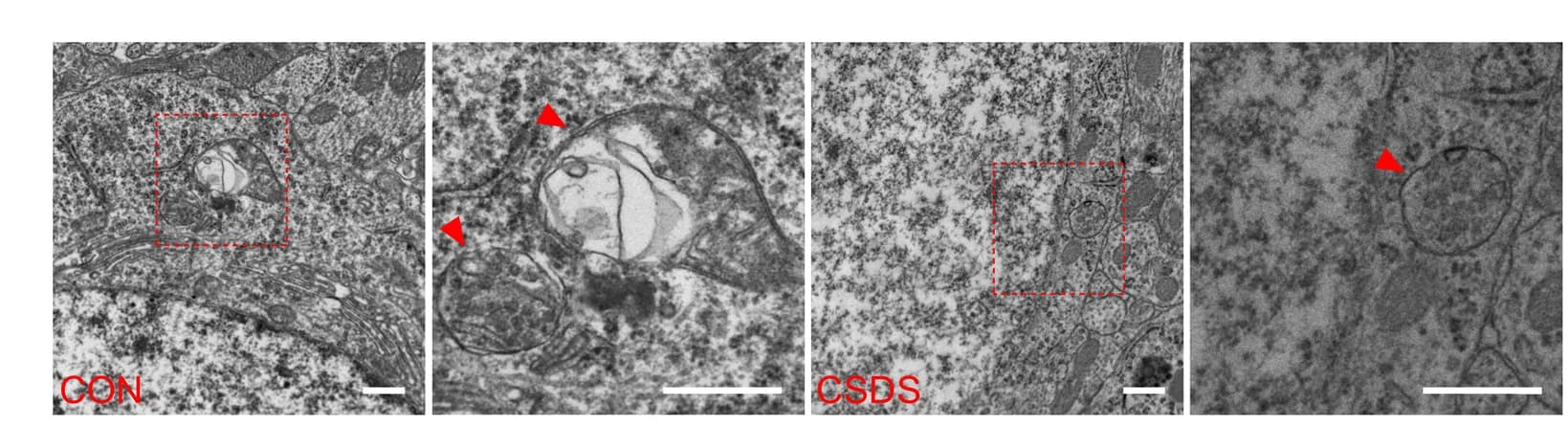 Open access visualization of Microscopy, Electron Micrographs, Autophagic Vacuoles, DG, Control Mice