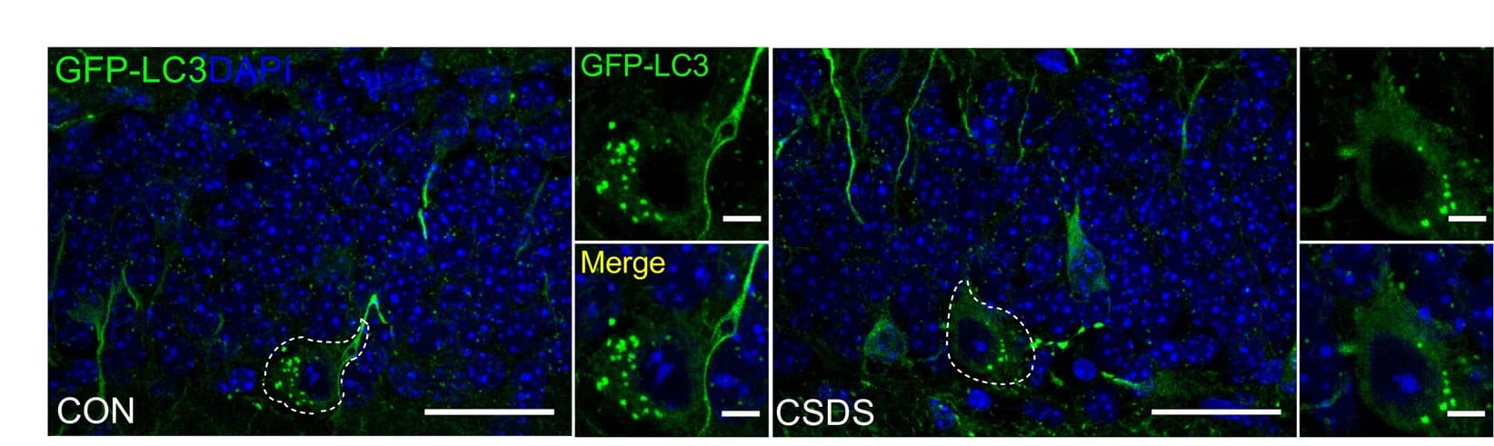 Open access visualization of Microscopy, Representative Images, GFP-LC3 Puncta, DG