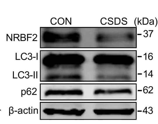 Open access visualization of Gel, Western Blotting, NRBF2, LC3-II, p62