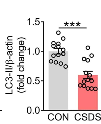 Open access visualization of Bar Plot, Error Bars, Scatter Plot, Quantification, LC3-II