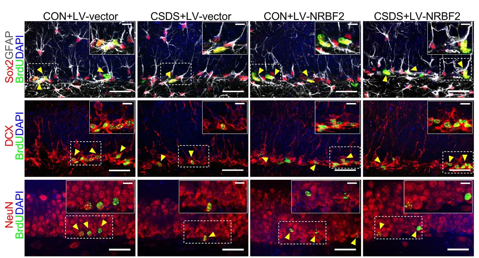 Open access visualization of Microscopy, BrdU, Sox2, GFAP, RGLs