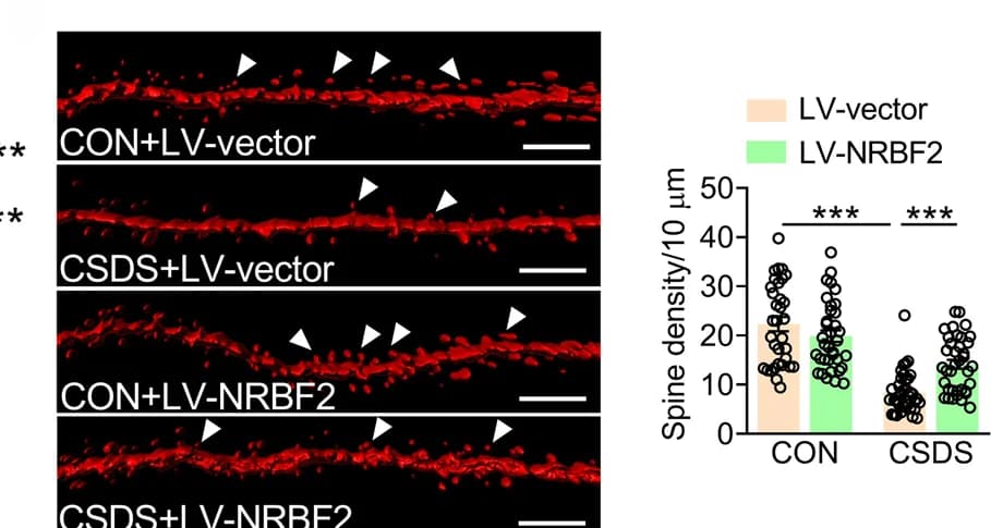 Open access visualization of Bar Plot, Scatter Plot, Representative Images, Quantification, Dendritic Spine Density