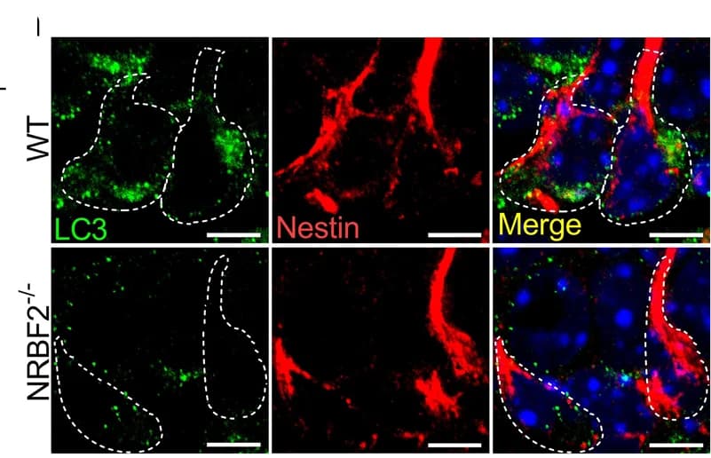 Open access visualization of Microscopy, LC3 Puncta, Nestin + Cells, DG, Representative Images