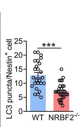 Open access visualization of Bar Plot, Scatter Plot, Error Bars, LC3 Puncta, Nestin + Cells