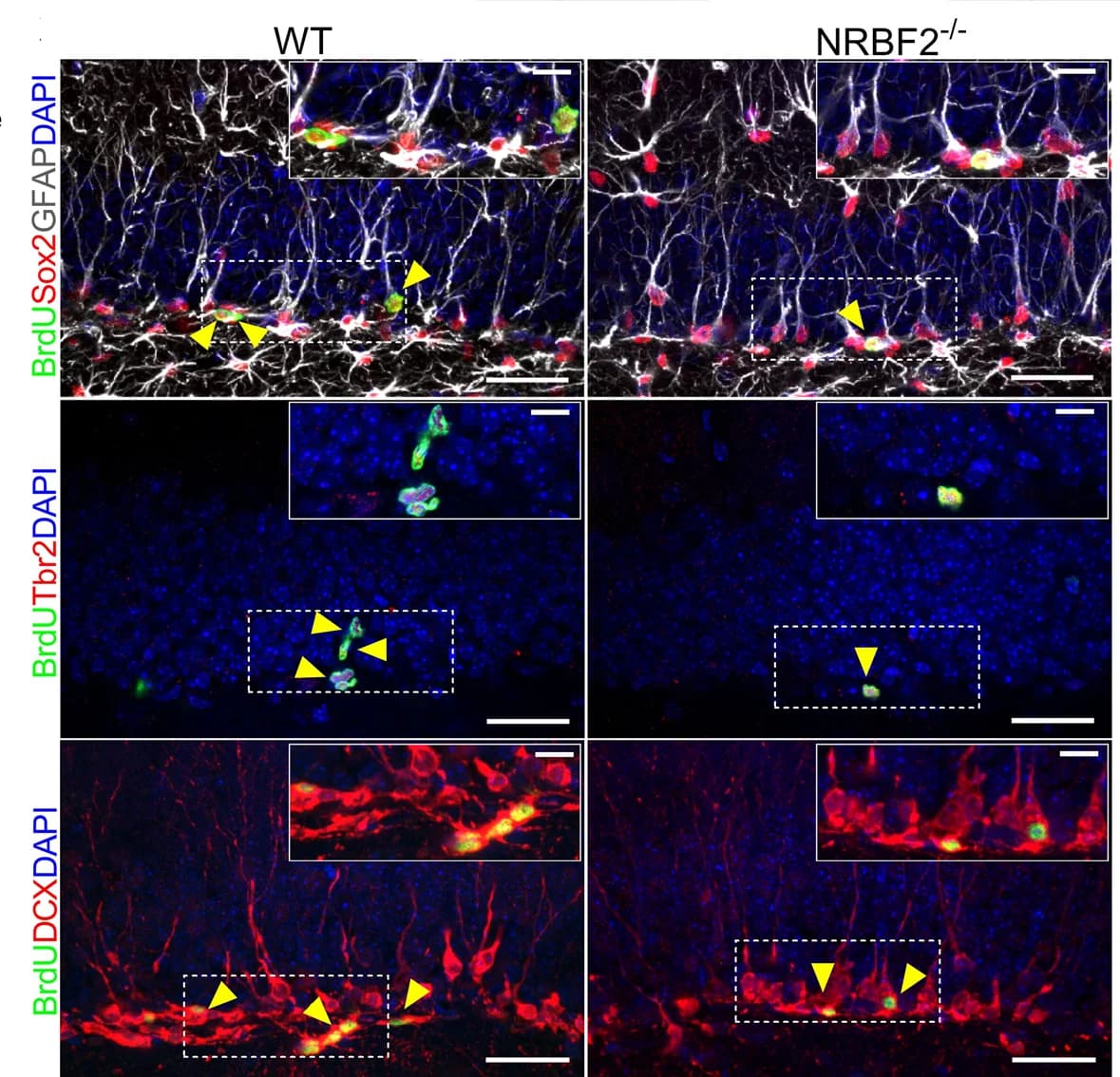 Open access visualization of Microscopy, BrdU + Sox2 + GFAP + RGLs, BrdU + Tbr2 + IPCs, BrdU + DCX + Neuroblasts, DG