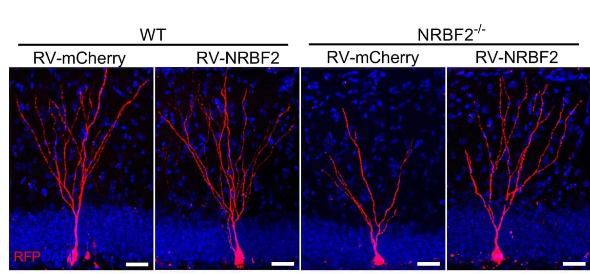 Open access visualization of Microscopy, mCherry + newborn neurons