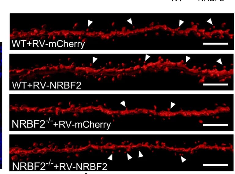 Open access visualization of Microscopy, Dendritic Spine