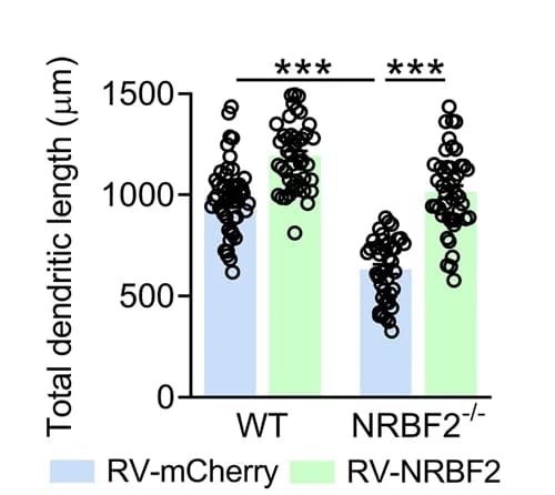 Open access visualization of Bar Plot, Scatter Plot, Dendritic Length, mCherry + newborn neurons