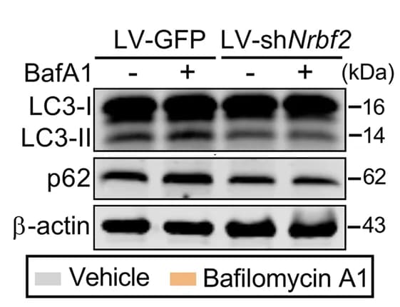 Open access visualization of Gel, Western Blotting, LC3-II, p62, NRBF2