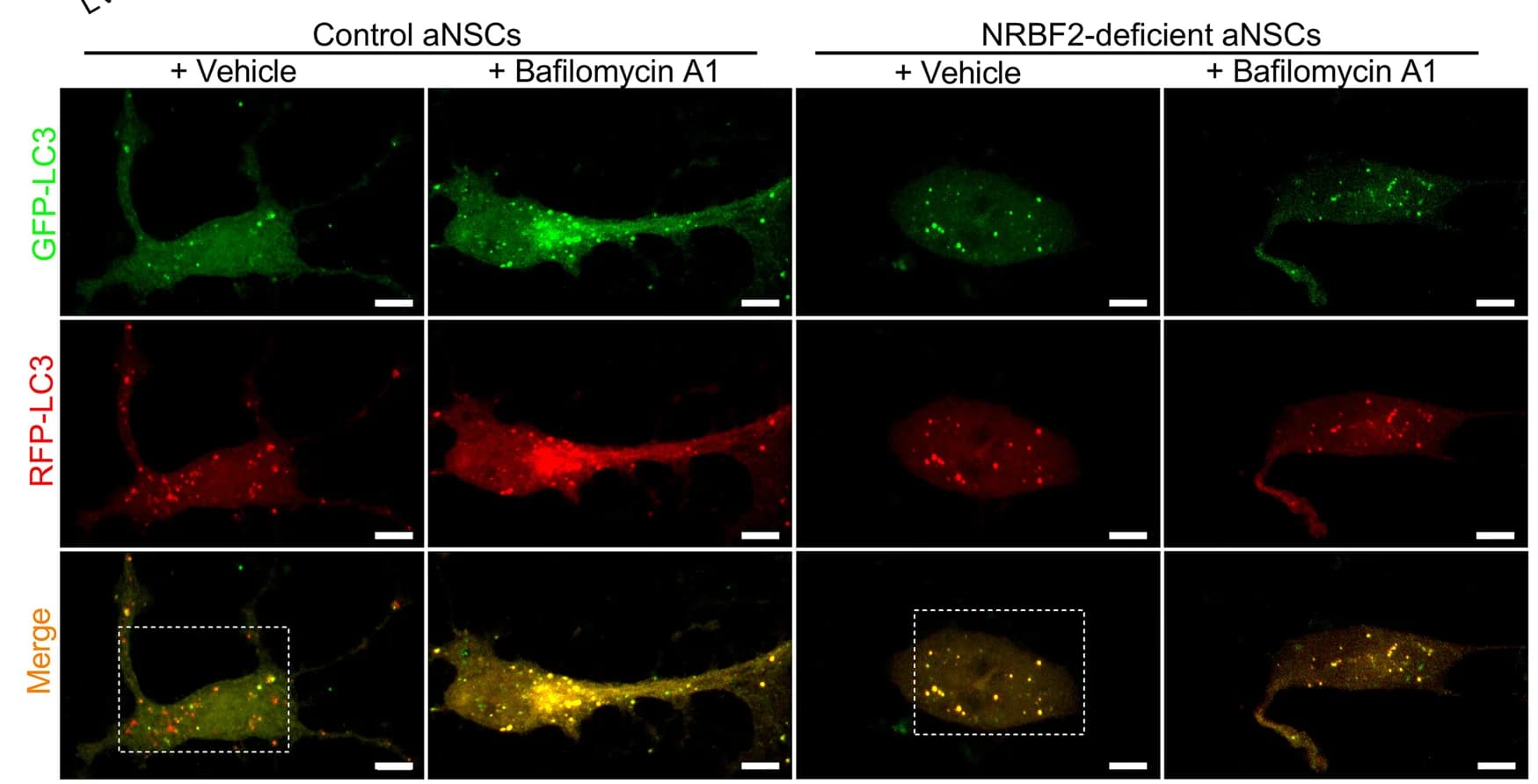 Open access visualization of Microscopy, GFP-RFP-LC3 puncta, RFP-LC3 puncta, Representative Images