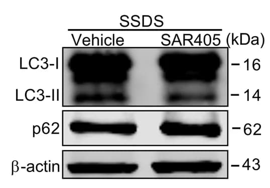 Open access visualization of Gel, Western Blotting, DG