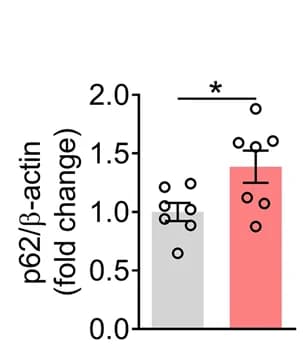Open access visualization of Bar Plot, Error Bars, Quantification, p62 Protein Expression, DG