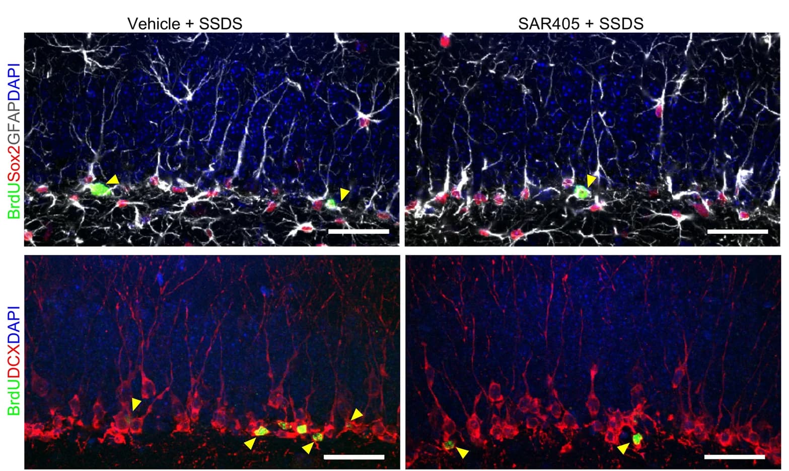 Open access visualization of Microscopy, BrdU+ Sox2+ GFAP+ RGLs, BrdU+ DCX+ Neuroblasts, DG, Images