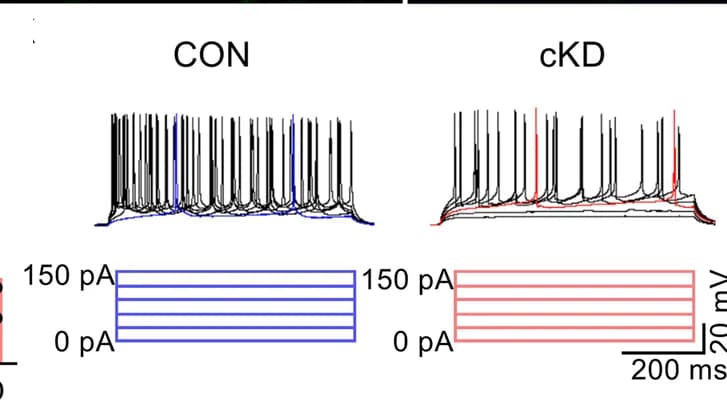 Open access visualization of Line Plot, Line Step, Spiking Pattern, Newborn Neurons, Current Injection
