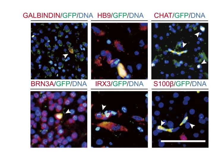 Open access visualization of Microscopy, IF Staining, Bat/Chick Chimera, Neural Markers, GFP