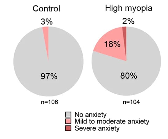 Open access visualization of Pie Chart, Anxiety, Myopia, Control Group