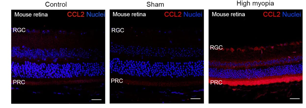 Open access visualization of Microscopy, Immunofluorescence, CCL2 Staining, Mouse Retina, Myopia