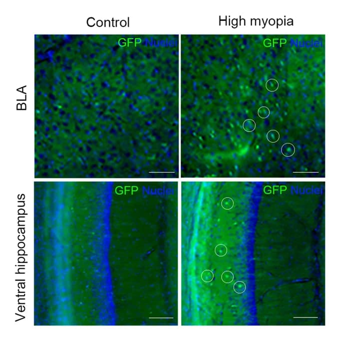 Open access visualization of Microscopy, Immunofluorescence, GFP, BLA, Hippocampus