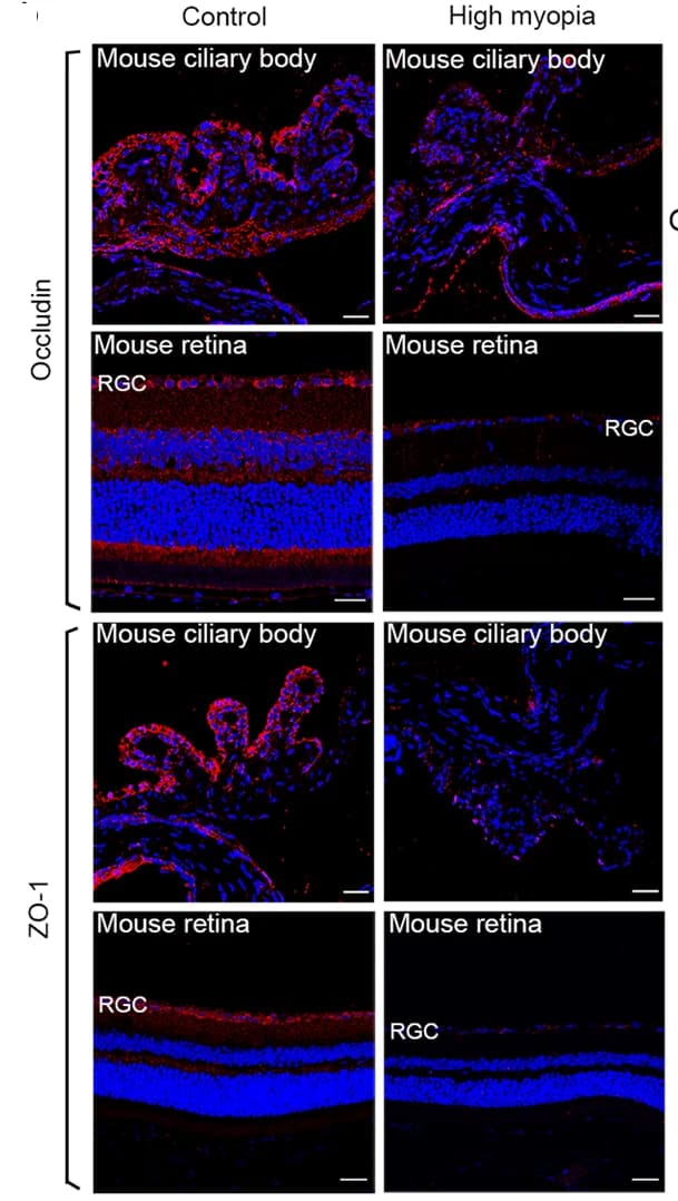 Open access visualization of Microscopy, Immunofluorescence, Tight Junction Proteins, Occludin, ZO-1