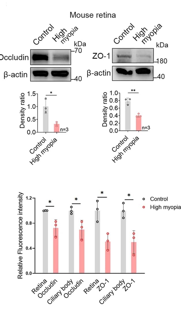 Open access visualization of Bar Plot, Error Bars, Photo, Gel, Western Blot