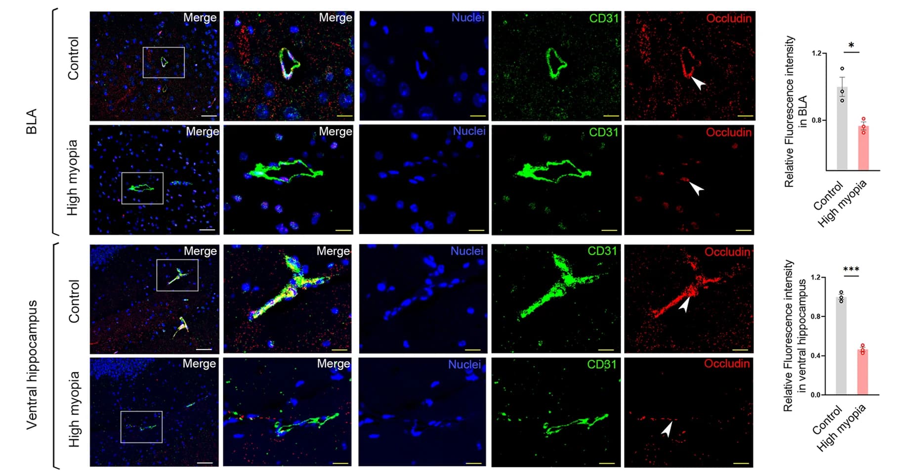 Open access visualization of Microscopy, Bar Plot, Immunofluorescence, Tight Junction Protein, Occludin