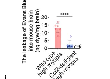 Open access visualization of Bar Plot, Error Bars, EB leakage, Brain, Mice
