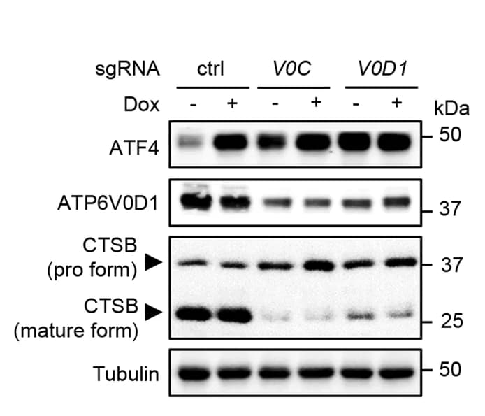 Open access visualization of Gel, Western Blot, HEK293T Cells, ATP6V0C, ATP6V0D1