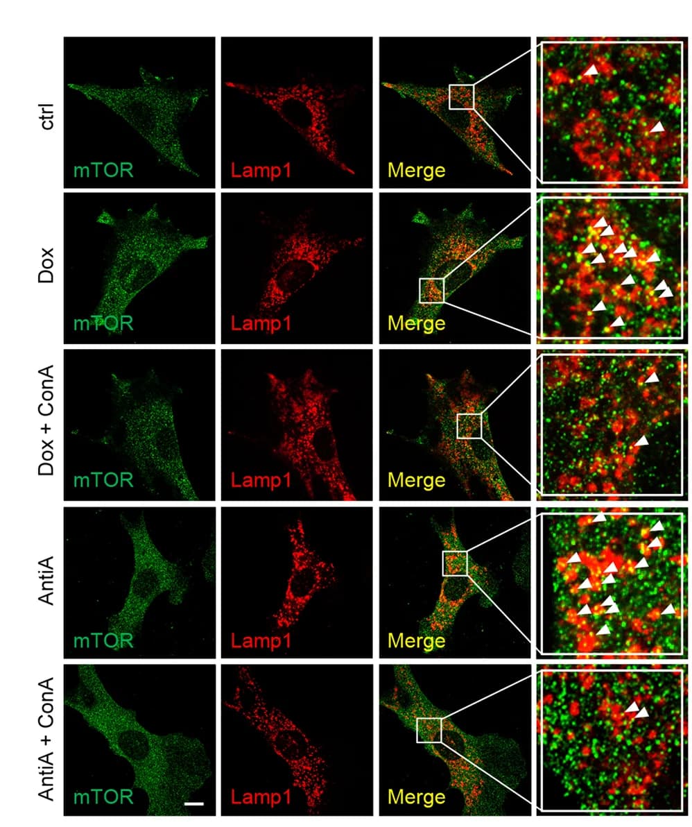 Open access visualization of Microscopy, ConA, Mitochondrial Stress, Lysosomal Localization, mTOR