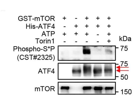 Open access visualization of Gel, mTOR, ATF4, In Vitro Kinase Assay, Phosphorylation