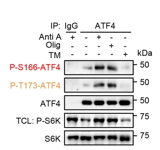 Open access visualization of Gel, ATF4 Phosphorylation, Mitochondrial Stress, ER Stress, Antimycin A