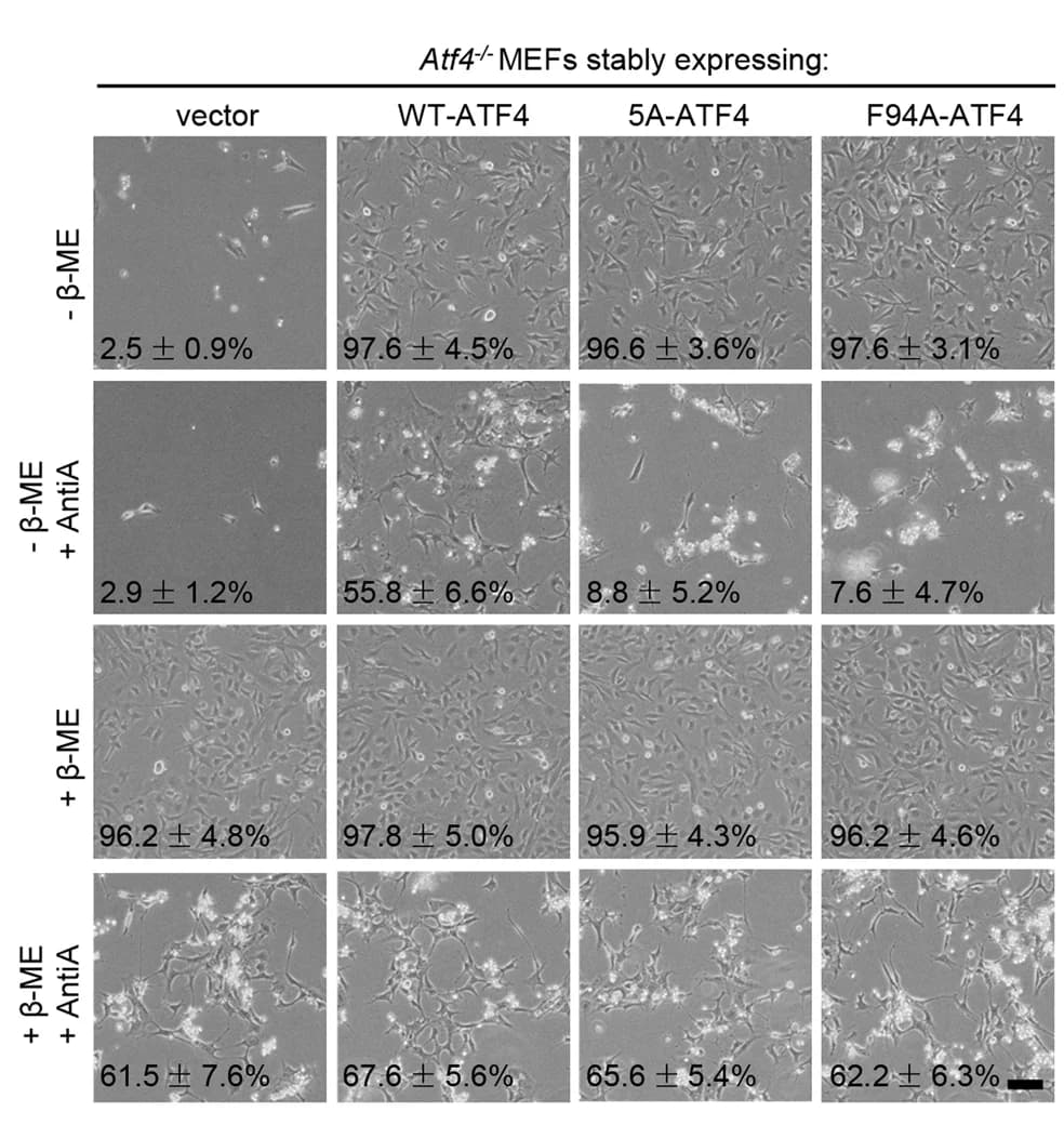 Open access visualization of Microscopy, Bright field photographs, Atf4 -/- MEFs, Empty vector, Wild-type ATF4