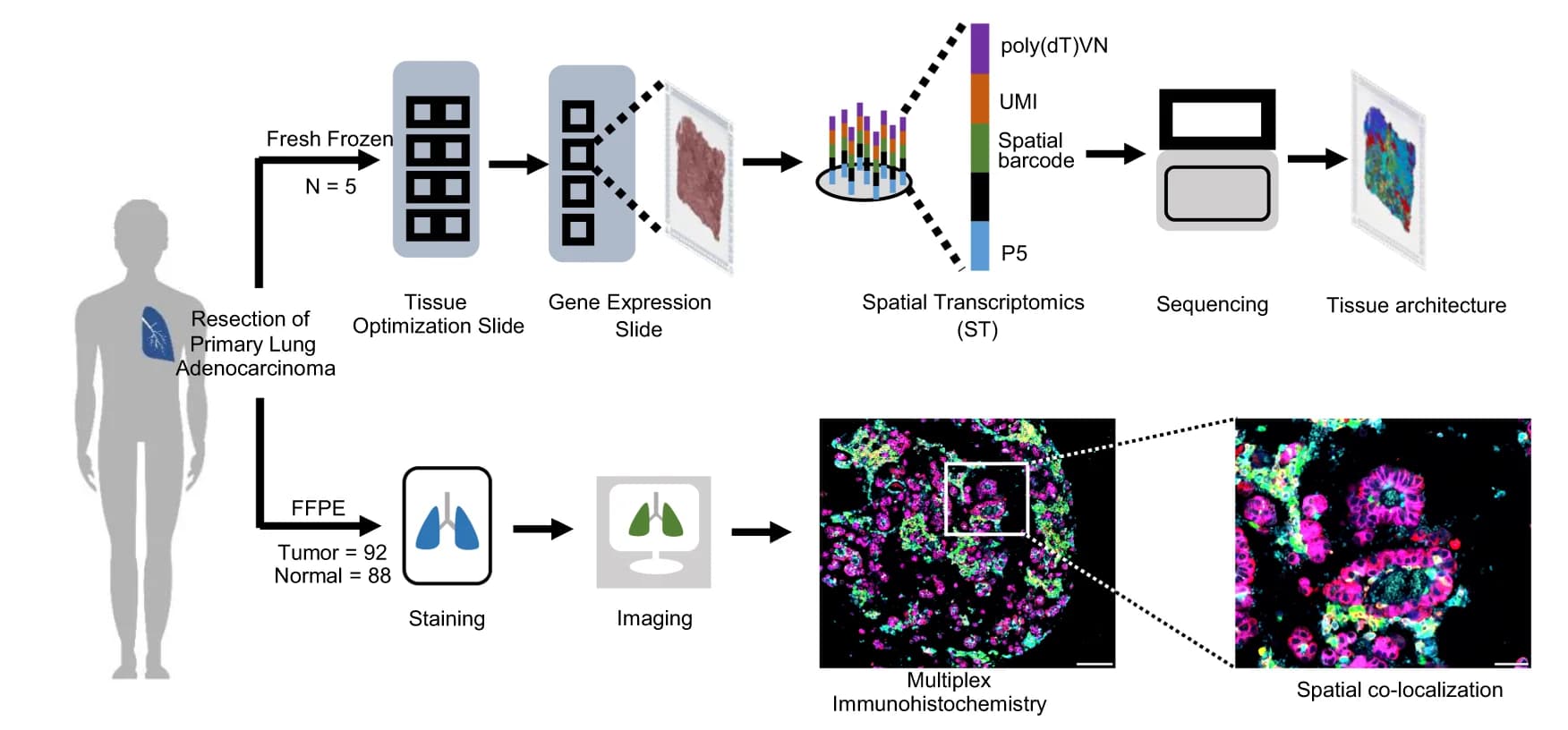 Open access visualization of Workflow, Illustration, Spatial Transcriptomics, Multiplex Immunohistochemistry, Sample Processing