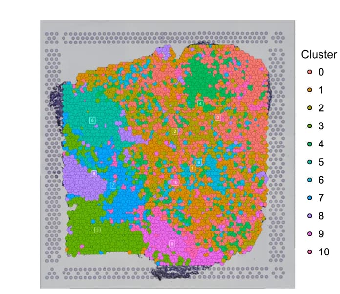 Open access visualization of Scatter Plot, Spatial Distribution, Clustering, ST_P1, ST Spots