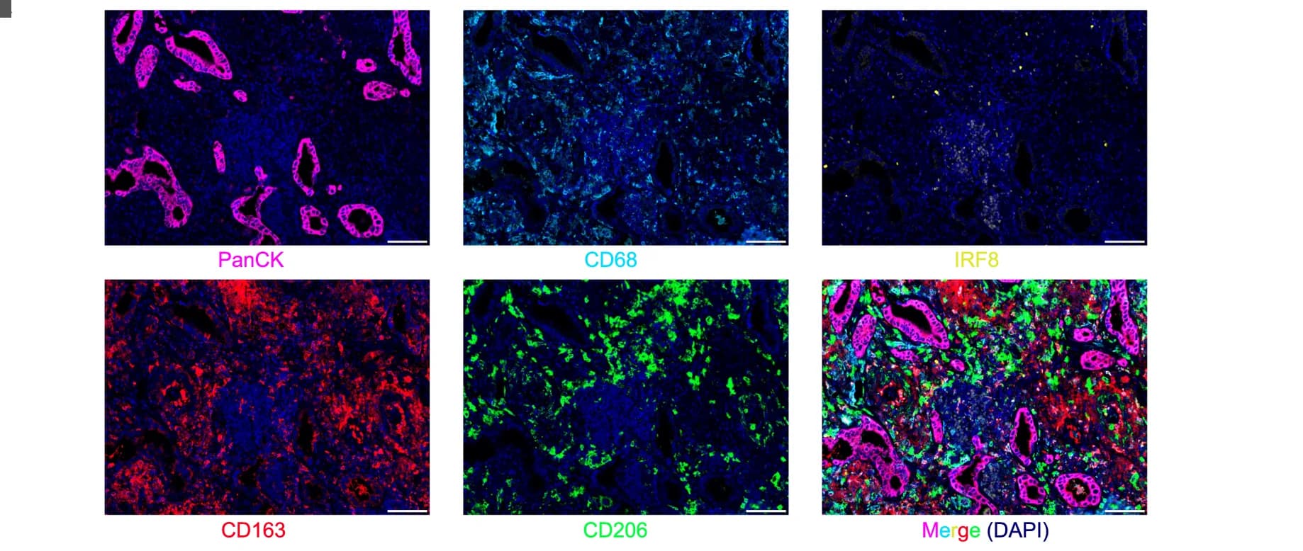 Open access visualization of Microscopy, LUAD Tissue, Multiplex IHC, DAPI, PanCK