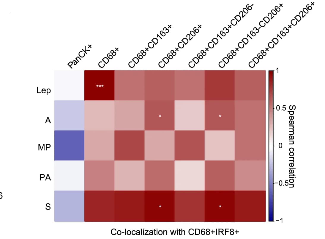 Open access visualization of Heatmap, CD68+ IRF8+ Macrophages, Spearman Correlation, Densities