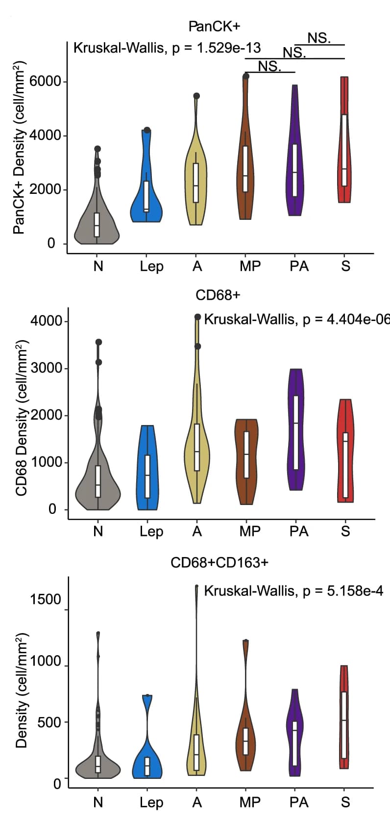 Open access visualization of Violin Plot, Box Plot, Raincloud Plot, TAM Subpopulations, Histologic Subtypes