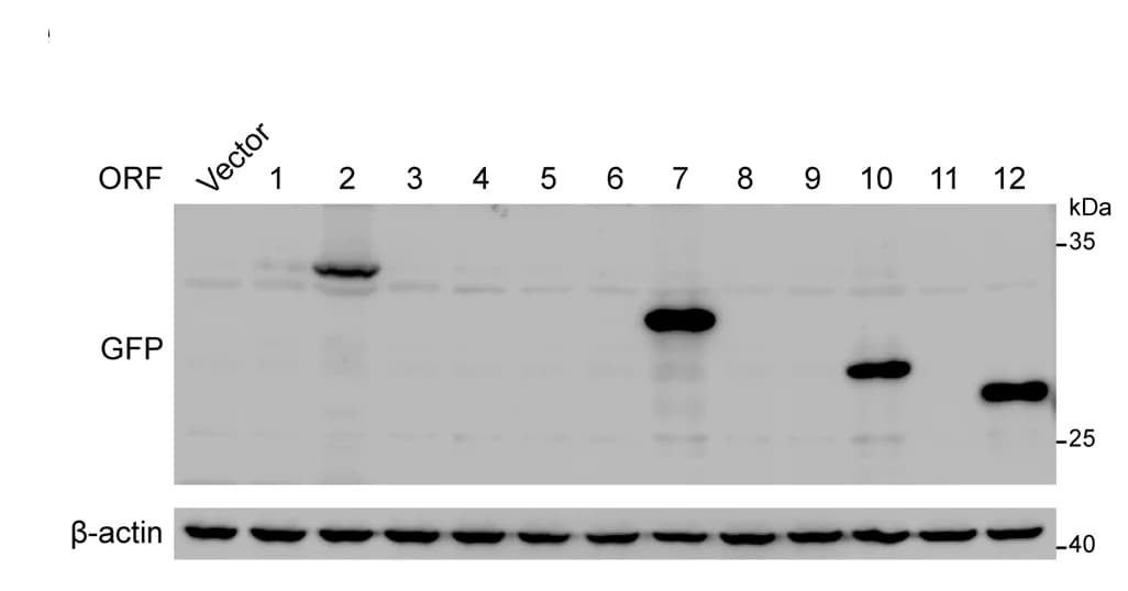 Open access visualization of Gel, GFP-tagged Polypeptides, LINC00261, Western Blotting, HEK293T