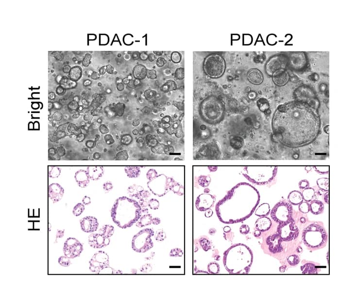 Open access visualization of Microscopy, Bright-field Image, Immunohistochemistry, PDAC-1, PDAC-2