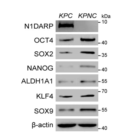 Open access visualization of Gel, Biomarkers, Stem-like Properties, Western Blot, Pancreatic Tumor