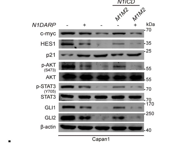 Open access visualization of Gel, Notch Signaling, Western Blotting Assay, Capan1, N1DARP