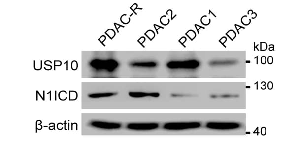 Open access visualization of Gel, Protein Expression, USP10, N1ICD, PDO