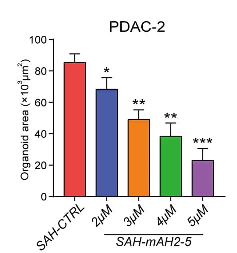 Open access visualization of Bar Plot, Error Bars, Organoid Area, Microscopy, PDO