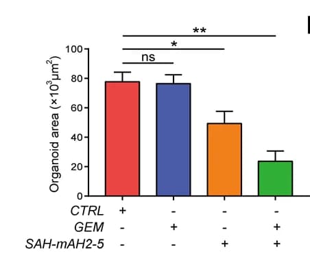Open access visualization of Bar Plot, Error Bars, Organoid Area, Apoptosis Rate, Calcein-AM/PI