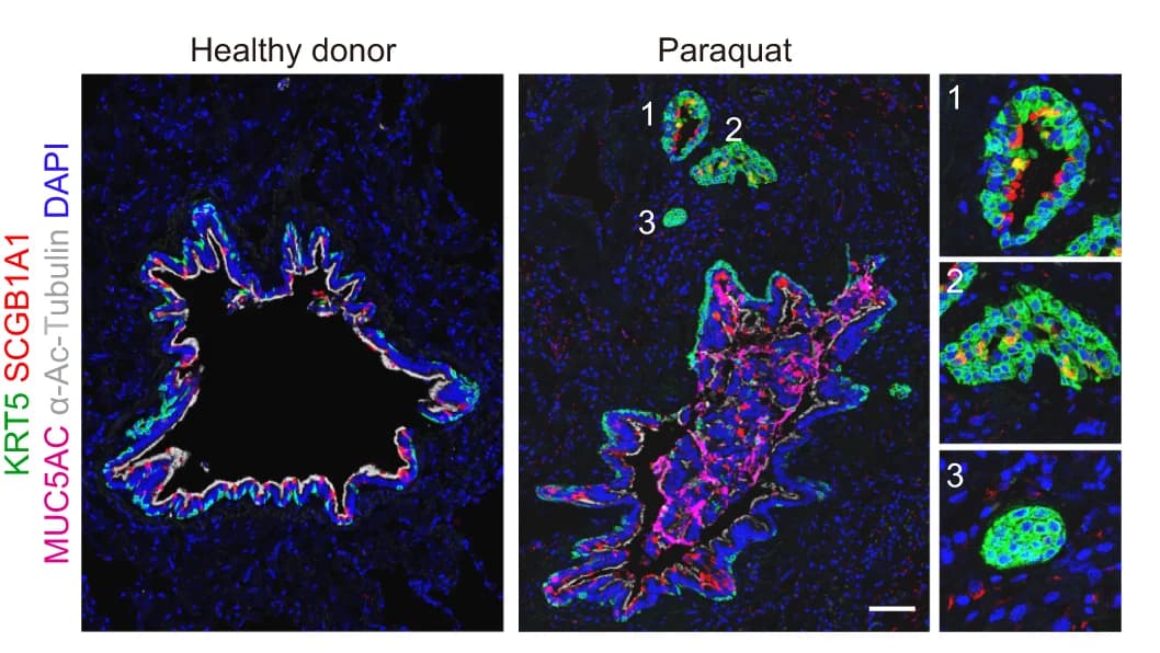 Open access visualization of Microscopy, Immunostaining, KRT5, Basal Cell Marker, SCGB1A1