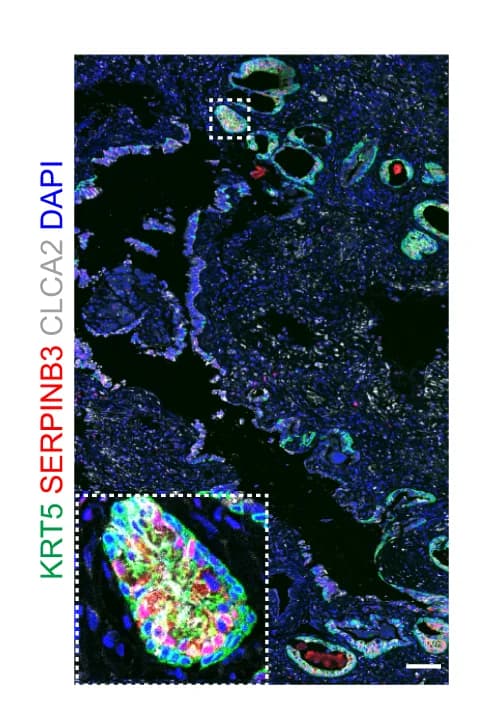 Open access visualization of Microscopy, Immunostaining, Paraquat-Injured Lung, KRT5, SERPINB3